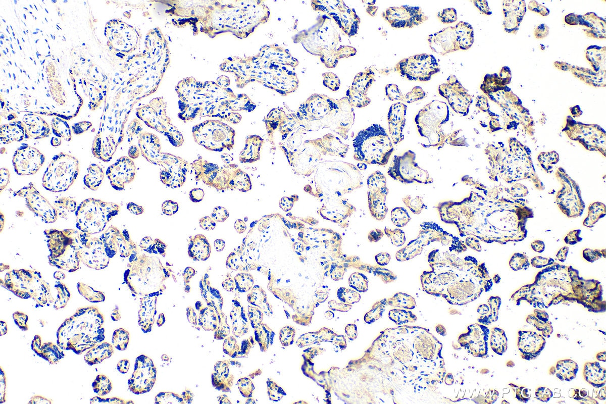 Immunohistochemistry (IHC) staining of human placenta tissue using Collagen Type XXVII Polyclonal antibody (15673-1-AP)