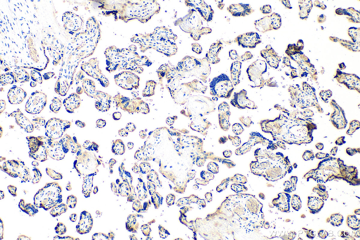 IHC staining of human placenta using 15673-1-AP