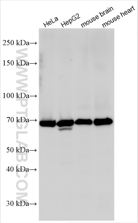 Western Blot (WB) analysis of various lysates using Collagen Type XXVII Polyclonal antibody (15673-1-AP)