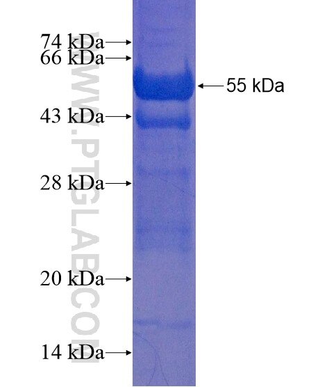 COL28A1 fusion protein Ag21459 SDS-PAGE