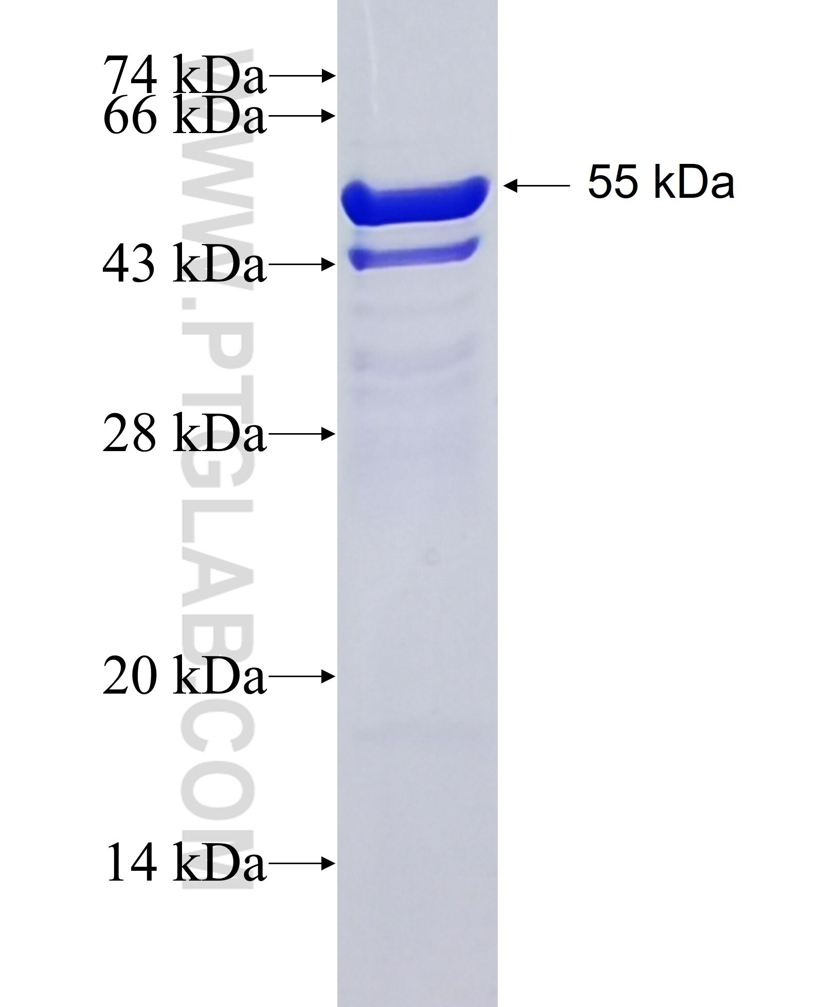 COL28A1 fusion protein Ag21459 SDS-PAGE