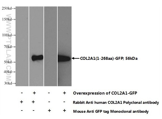 Collagen Type II Polyclonal antibody