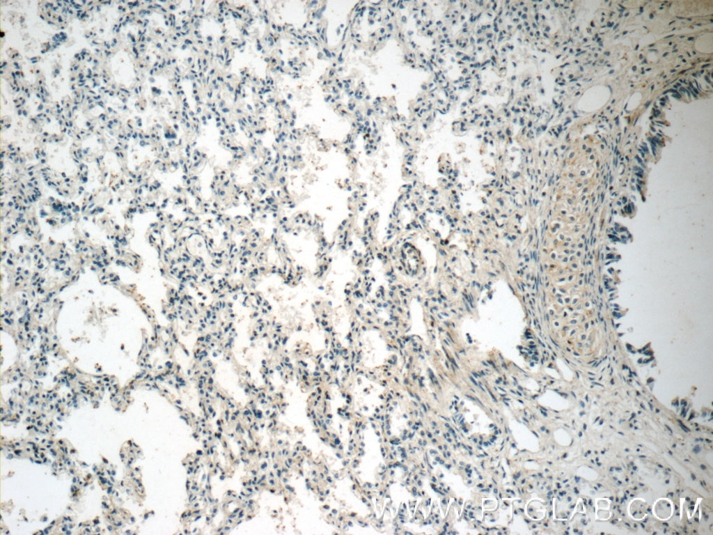 Immunohistochemistry (IHC) staining of human lung tissue using Collagen Type II Polyclonal antibody (15943-1-AP)
