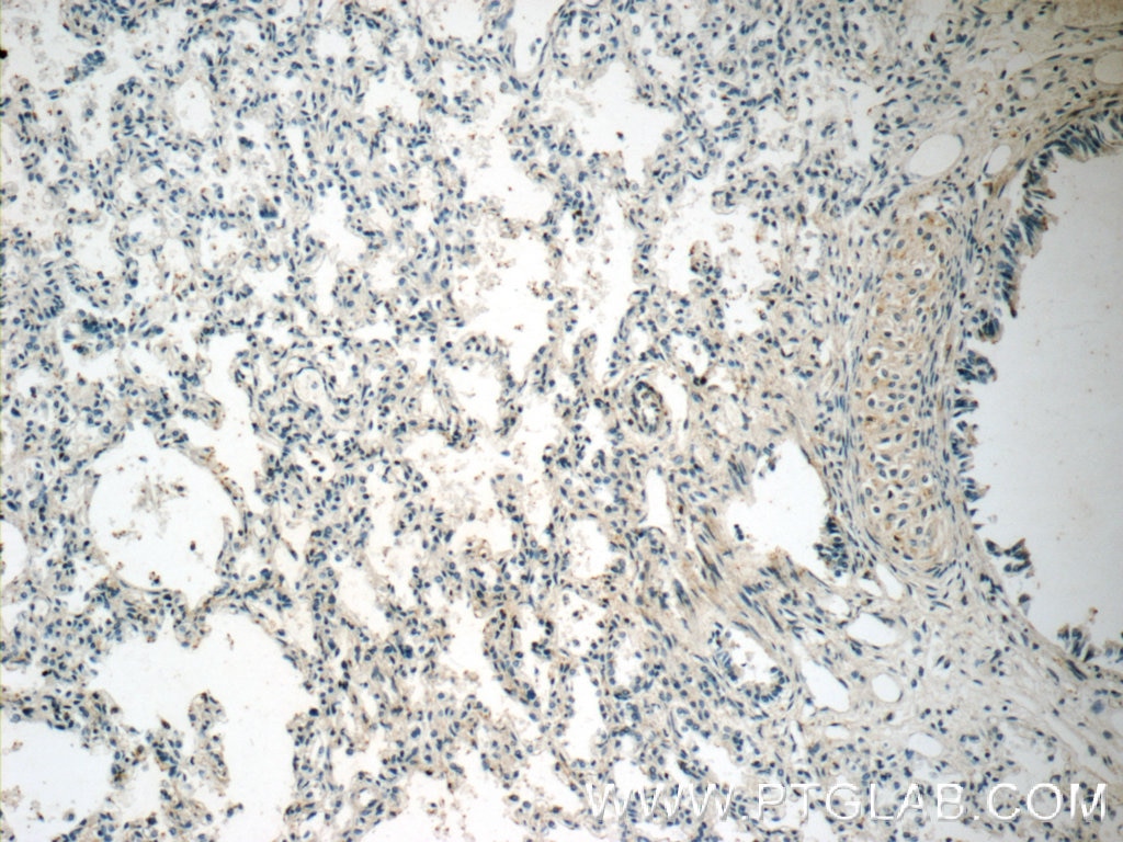 IHC staining of human lung using 15943-1-AP