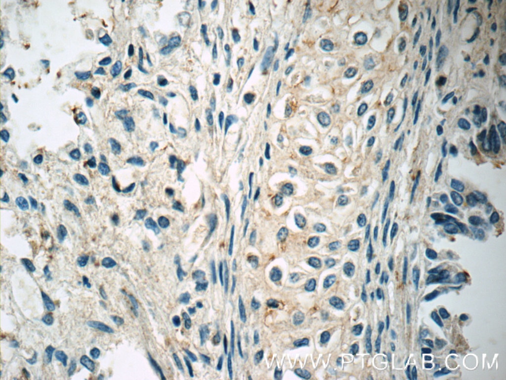 Immunohistochemistry (IHC) staining of human lung tissue using Collagen Type II Polyclonal antibody (15943-1-AP)