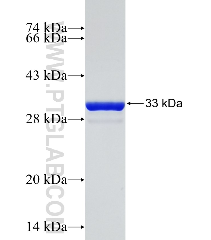COL2A1 fusion protein Ag29265 SDS-PAGE