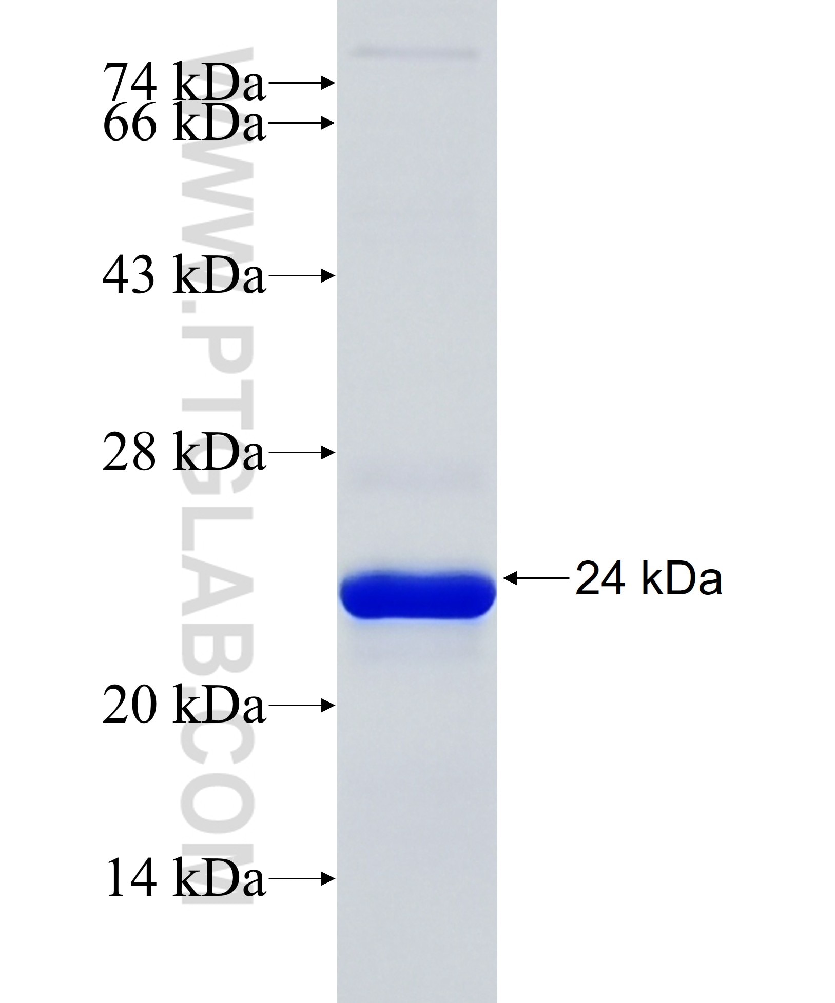 COL2A1 fusion protein Ag31576 SDS-PAGE COL2A1 fusion protein Ag31576 SDS-PAGE