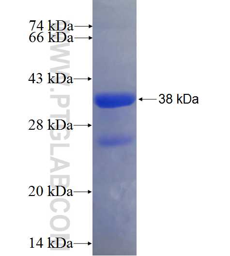 COL2A1 fusion protein Ag8416 SDS-PAGE