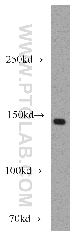 Collagen Type III (C-terminal) Polyclonal antibody