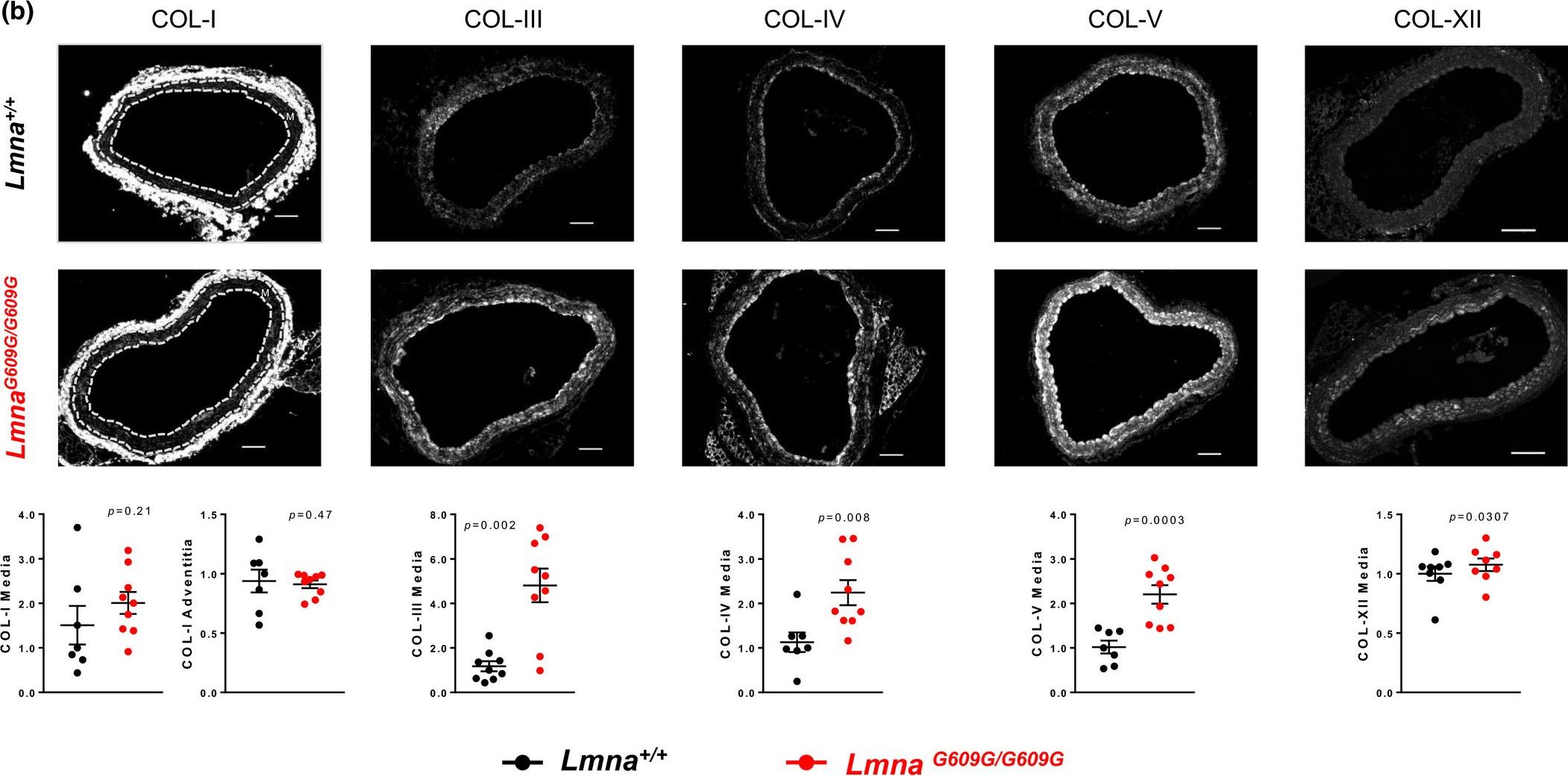 Collagen Type III (N-terminal)