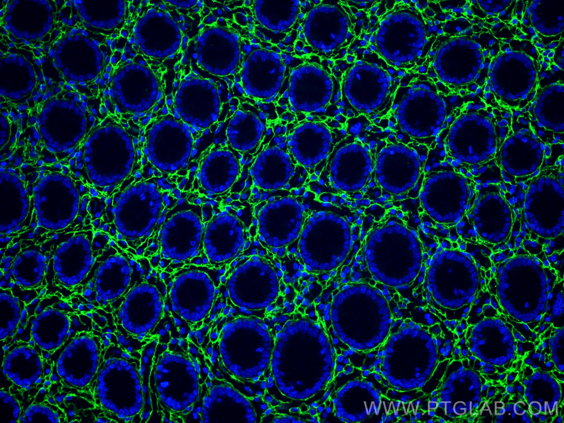 Immunofluorescence (IF) / fluorescent staining of human colon tissue using Collagen Type III (N-terminal) Polyclonal antibody (22734-1-AP)