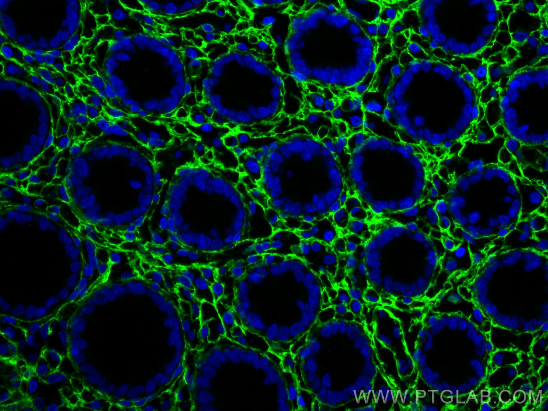 Immunofluorescence (IF) / fluorescent staining of human colon tissue using Collagen Type III (N-terminal) Polyclonal antibody (22734-1-AP)