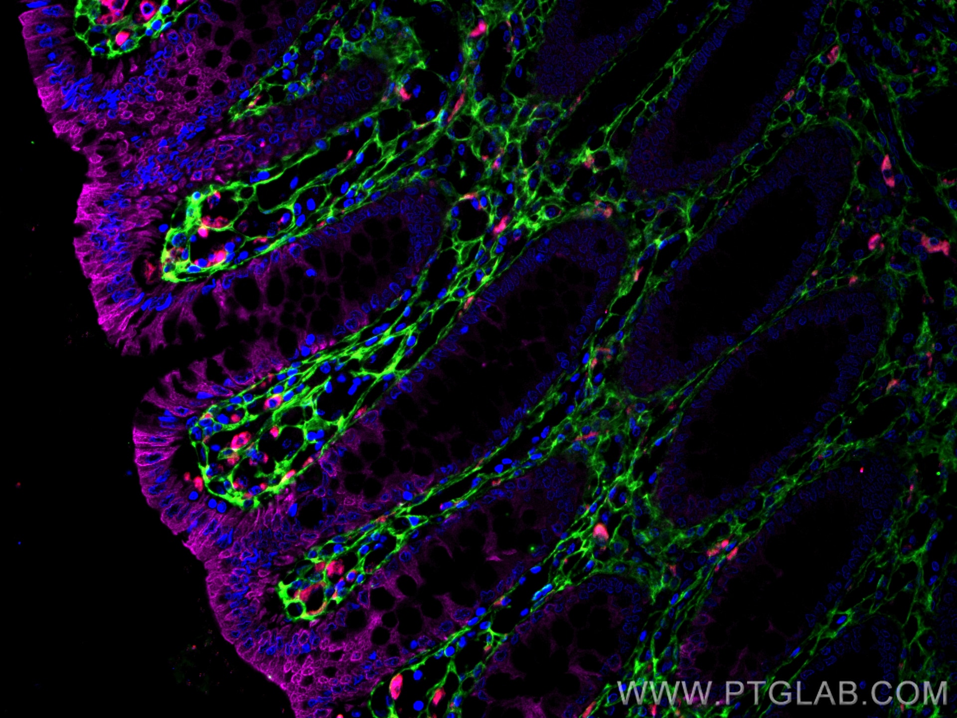 Immunofluorescence (IF) / fluorescent staining of human colon tissue using Collagen Type III (N-terminal) Polyclonal antibody (22734-1-AP)