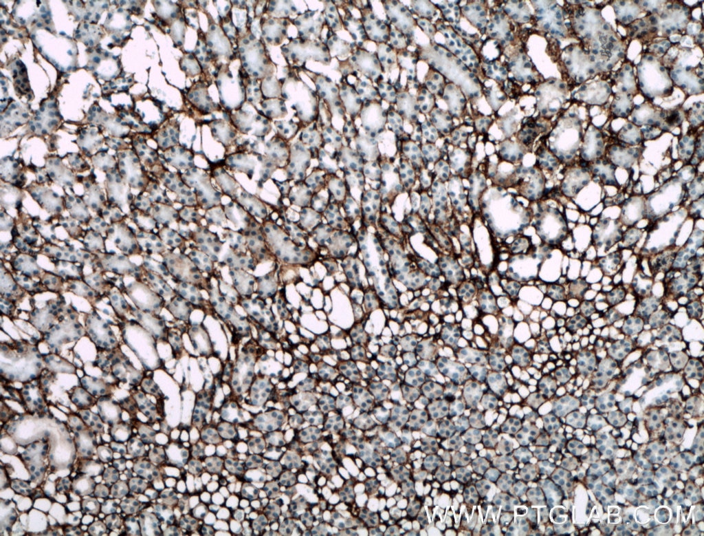 Immunohistochemistry (IHC) staining of mouse kidney tissue using Collagen Type III (N-terminal) Polyclonal antibody (22734-1-AP)