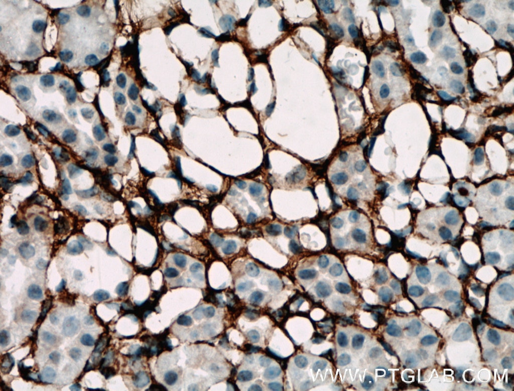 Immunohistochemistry (IHC) staining of mouse kidney tissue using Collagen Type III (N-terminal) Polyclonal antibody (22734-1-AP)