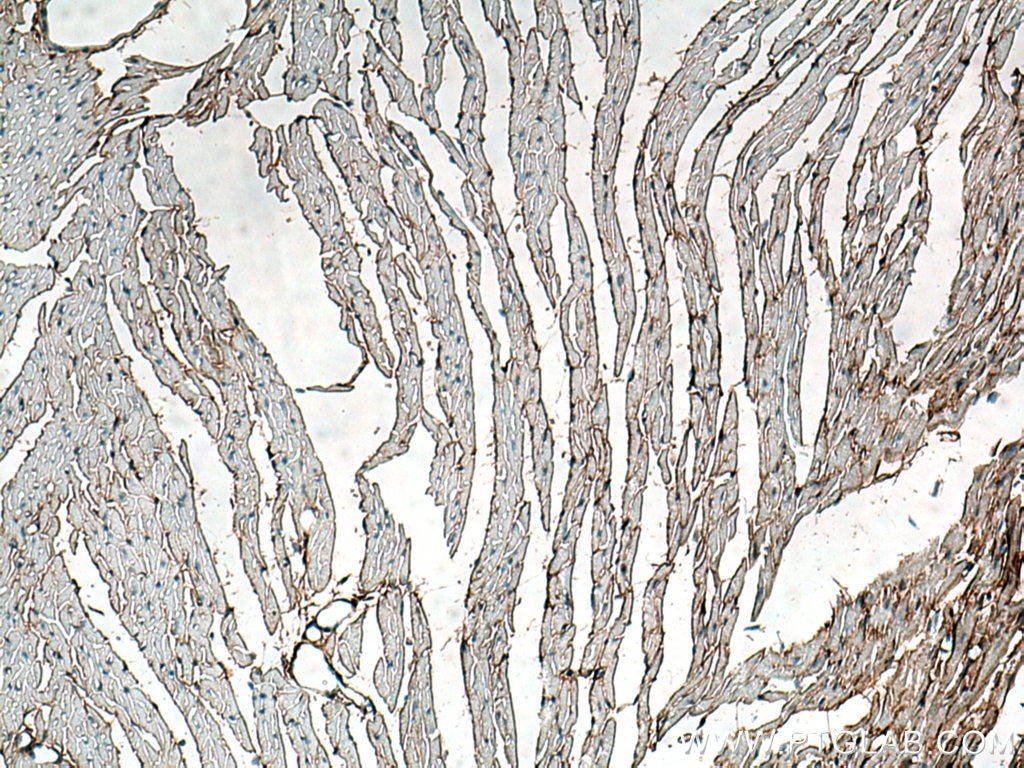 Immunohistochemistry (IHC) staining of mouse heart tissue using Collagen Type III (N-terminal) Polyclonal antibody (22734-1-AP)