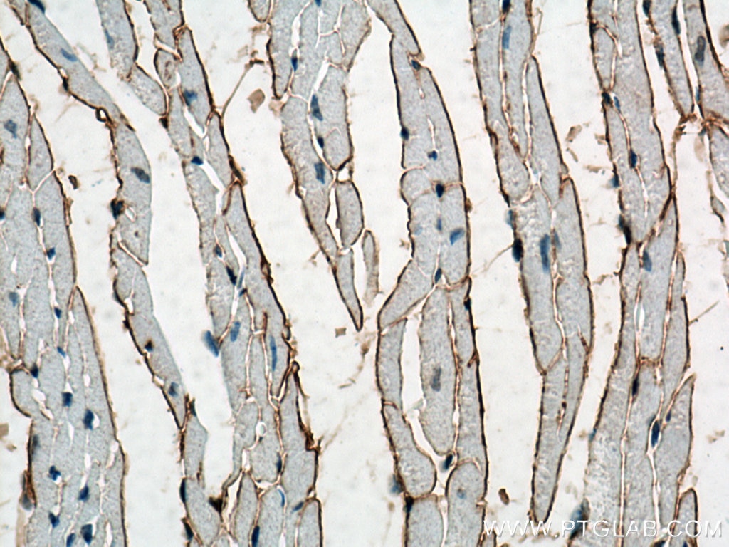 IHC staining of mouse heart using 22734-1-AP