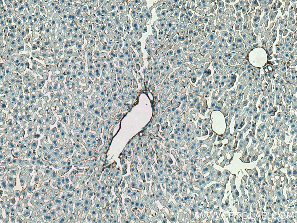 Immunohistochemistry (IHC) staining of mouse liver tissue using Collagen Type III (N-terminal) Polyclonal antibody (22734-1-AP)