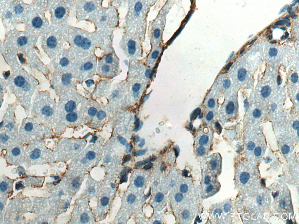 Immunohistochemistry (IHC) staining of mouse liver tissue using Collagen Type III (N-terminal) Polyclonal antibody (22734-1-AP)