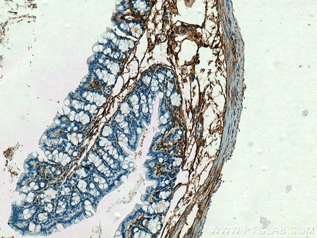 Immunohistochemistry (IHC) staining of mouse colon tissue using Collagen Type III (N-terminal) Polyclonal antibody (22734-1-AP)