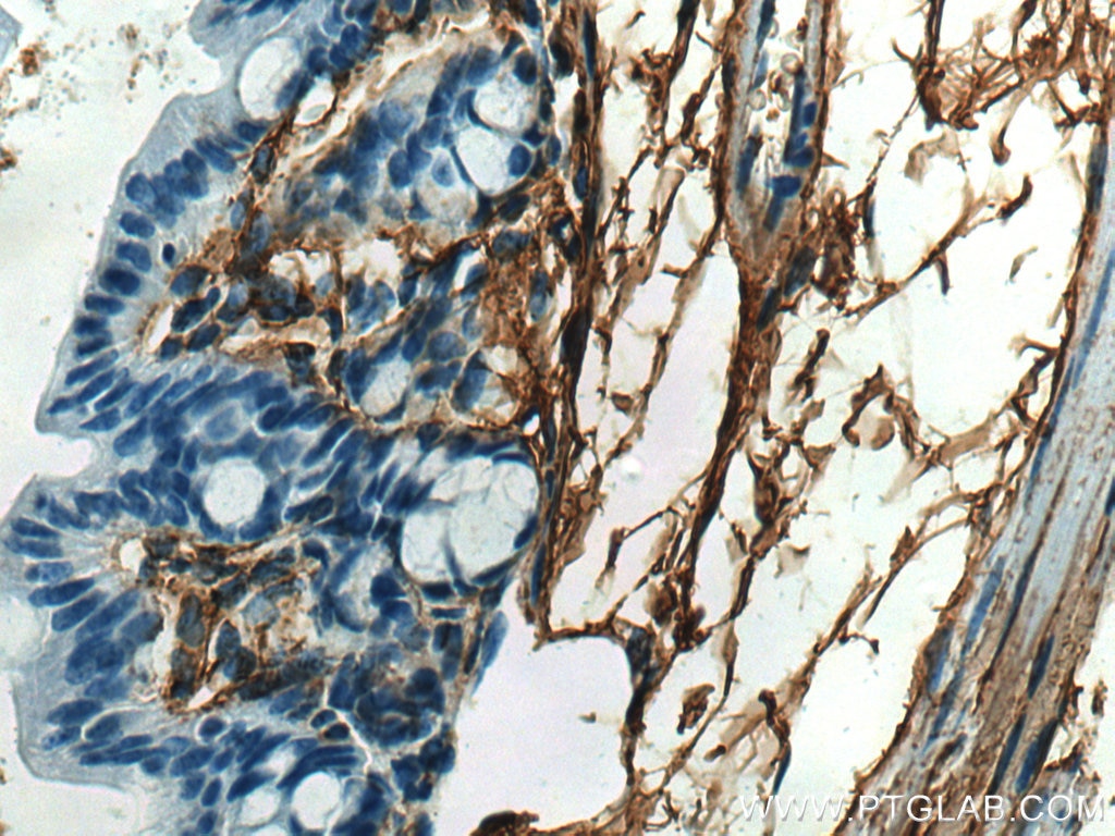 Immunohistochemistry (IHC) staining of mouse colon tissue using Collagen Type III (N-terminal) Polyclonal antibody (22734-1-AP)