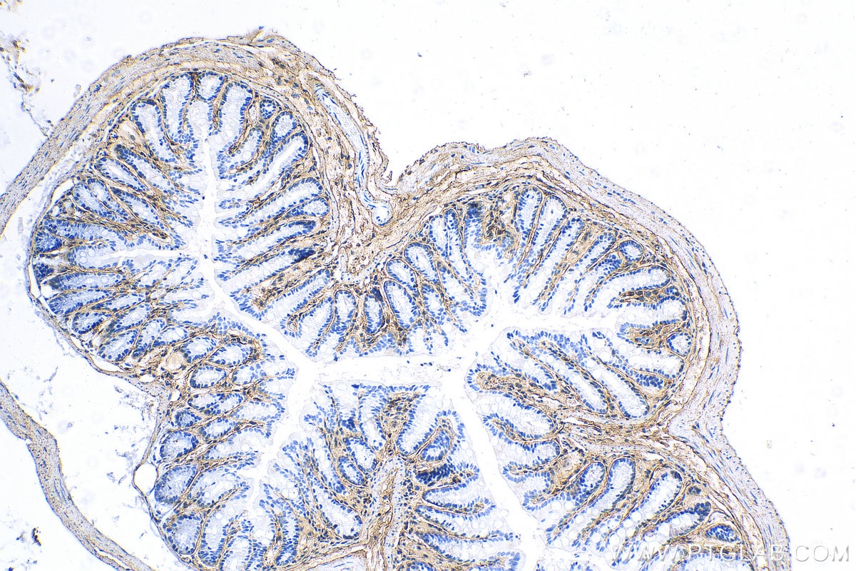 Immunohistochemistry (IHC) staining of mouse colon tissue using Collagen Type III (N-terminal) Polyclonal antibody (22734-1-AP)