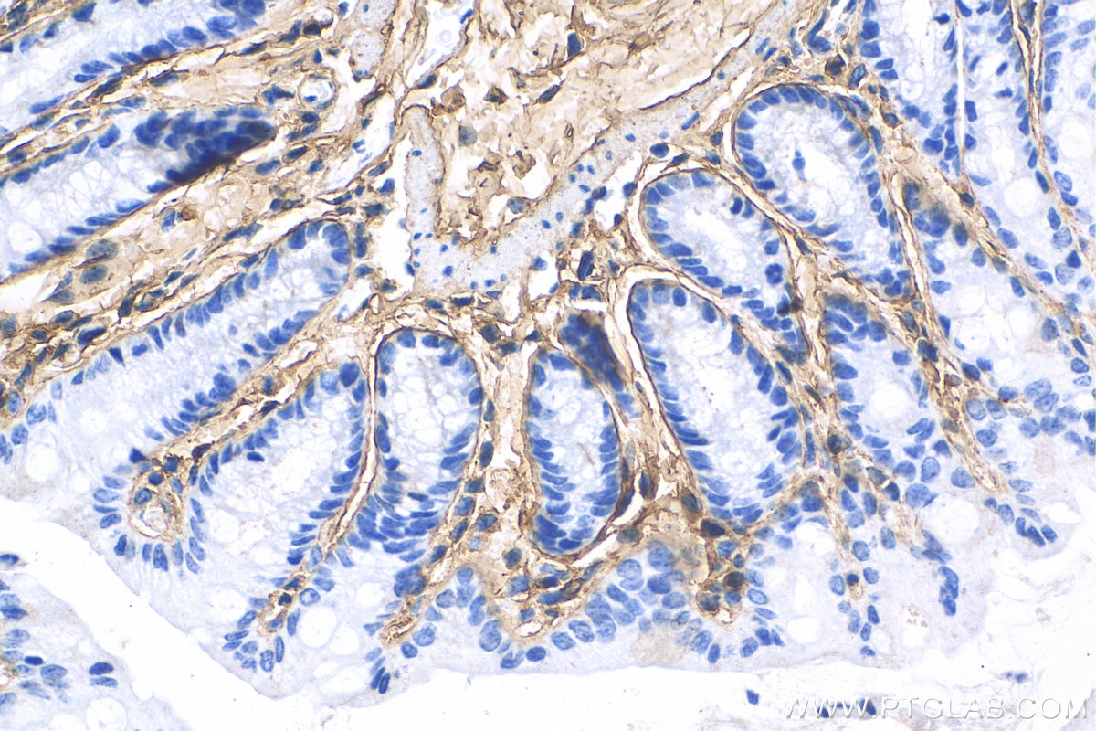 Immunohistochemistry (IHC) staining of mouse colon tissue using Collagen Type III (N-terminal) Polyclonal antibody (22734-1-AP)