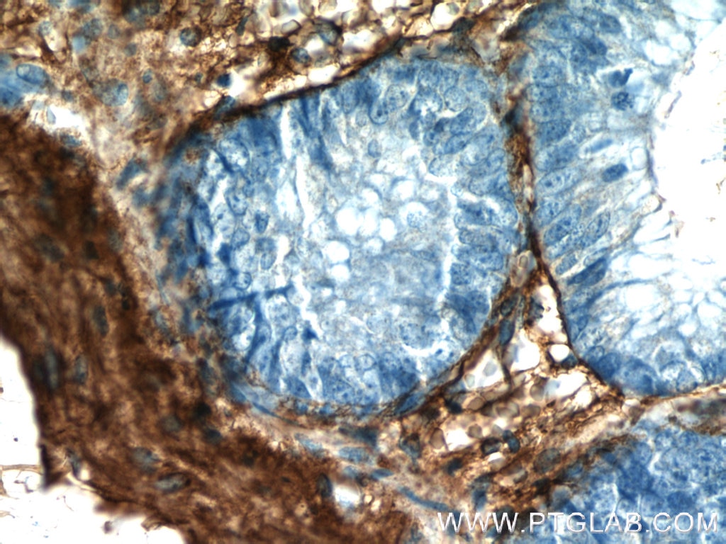 Collagen Type III (N-terminal) Polyclonal antibody