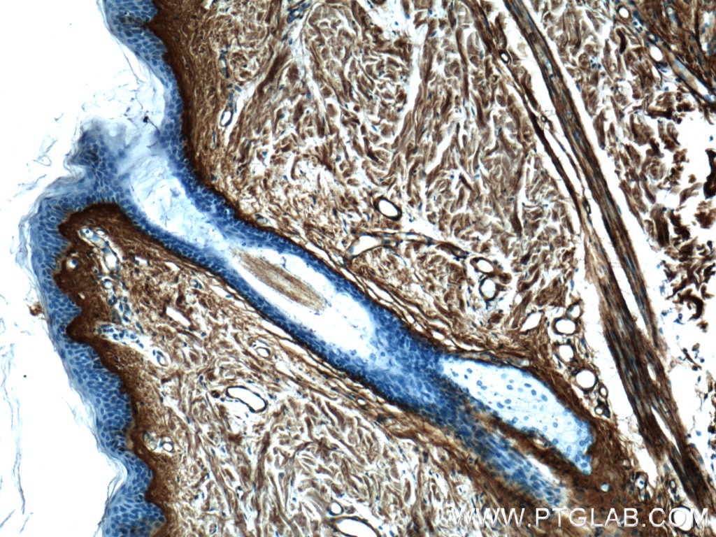 Immunohistochemistry (IHC) staining of human skin tissue using Collagen Type III (N-terminal) Polyclonal antibody (22734-1-AP)