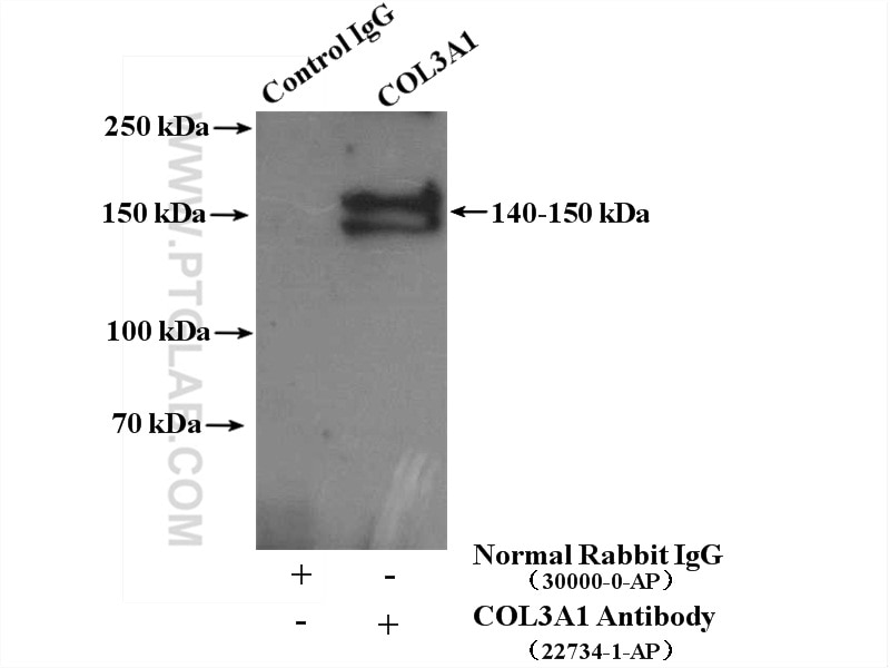 Immunoprecipitation (IP) experiment of mouse skin tissue using Collagen Type III (N-terminal) Polyclonal antibody (22734-1-AP)