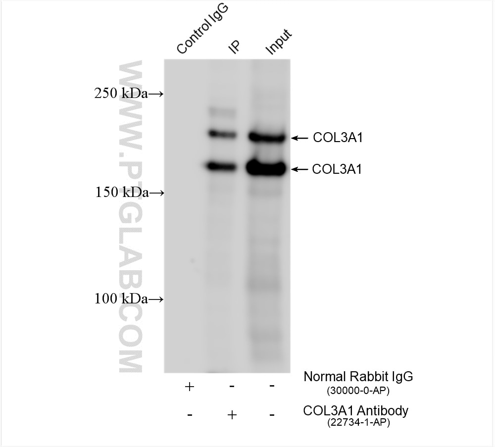 Immunoprecipitation (IP) experiment of mouse skin tissue using Collagen Type III (N-terminal) Polyclonal antibody (22734-1-AP)