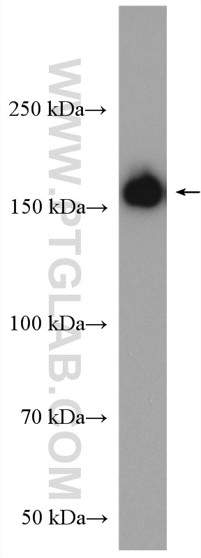 Western Blot (WB) analysis of rat skin tissue using Collagen Type III (N-terminal) Polyclonal antibody (22734-1-AP)