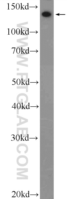 Western Blot (WB) analysis of mouse skin tissue using Collagen Type III (N-terminal) Polyclonal antibody (22734-1-AP)