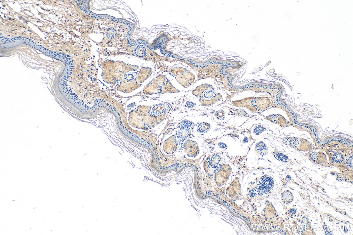 Immunohistochemistry (IHC) staining of mouse skin tissue using COL3A1 Monoclonal antibody (68320-1-Ig)