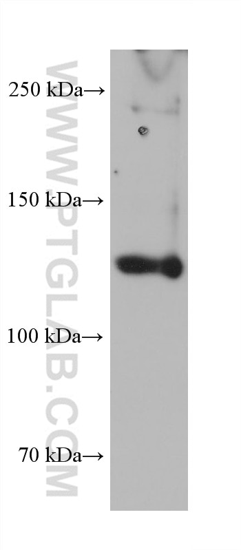 Western Blot (WB) analysis of human placenta tissue using COL3A1 Monoclonal antibody (68320-1-Ig)