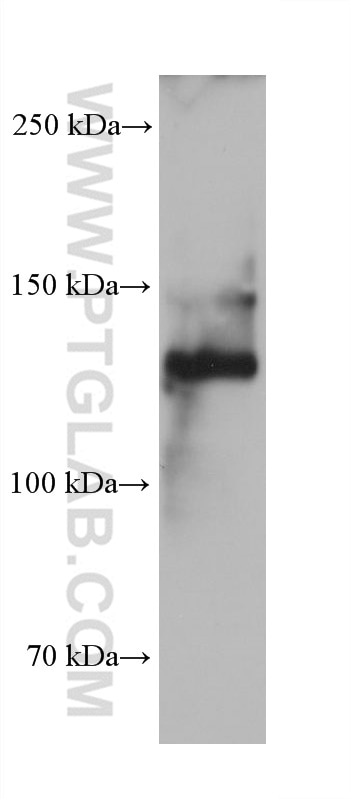 WB analysis of human rectum using 68320-1-Ig