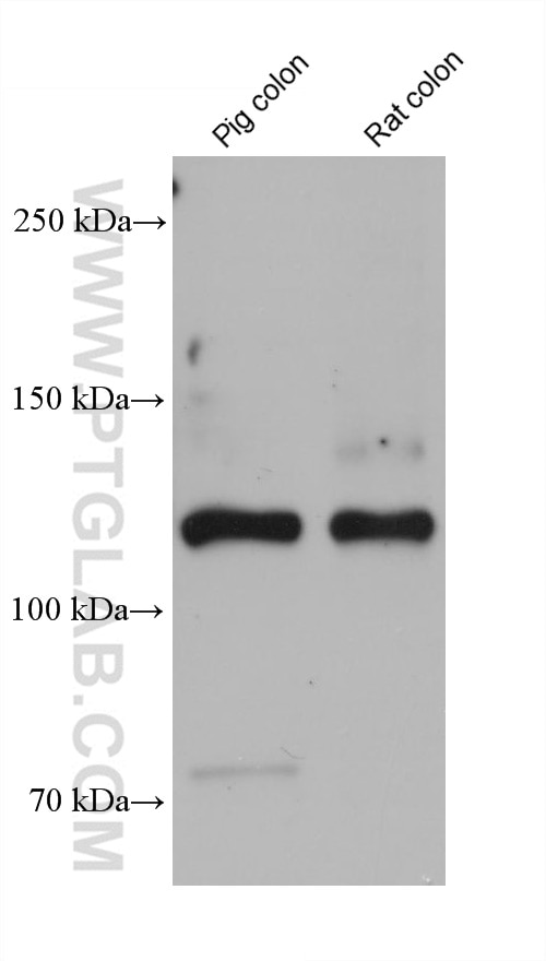 Western Blot (WB) analysis of various lysates using COL3A1 Monoclonal antibody (68320-1-Ig)