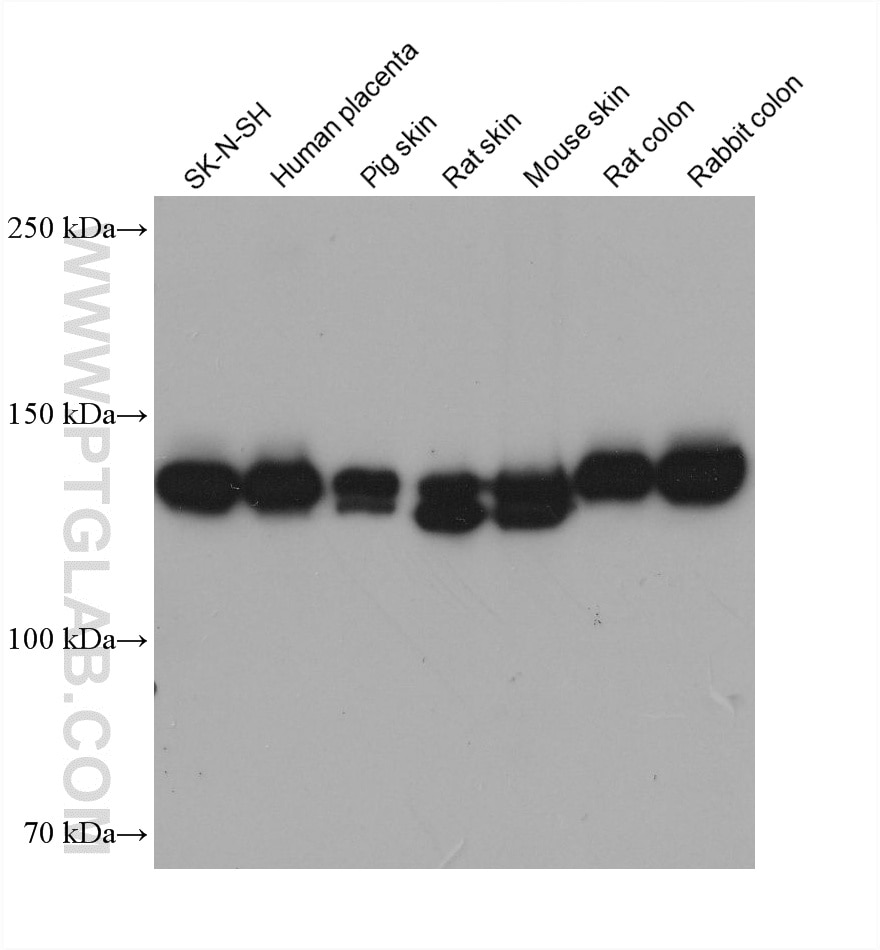 Various lysates were subjected to SDS PAGE followed by western blot with 68320-1-Ig (Collagen Type III antibody) at dilution of 1:10000 incubated at room temperature for 1.5 hours. Western Blot (WB) analysis of various lysates using Collagen Type III Monoclonal antibody (68320-1-Ig)