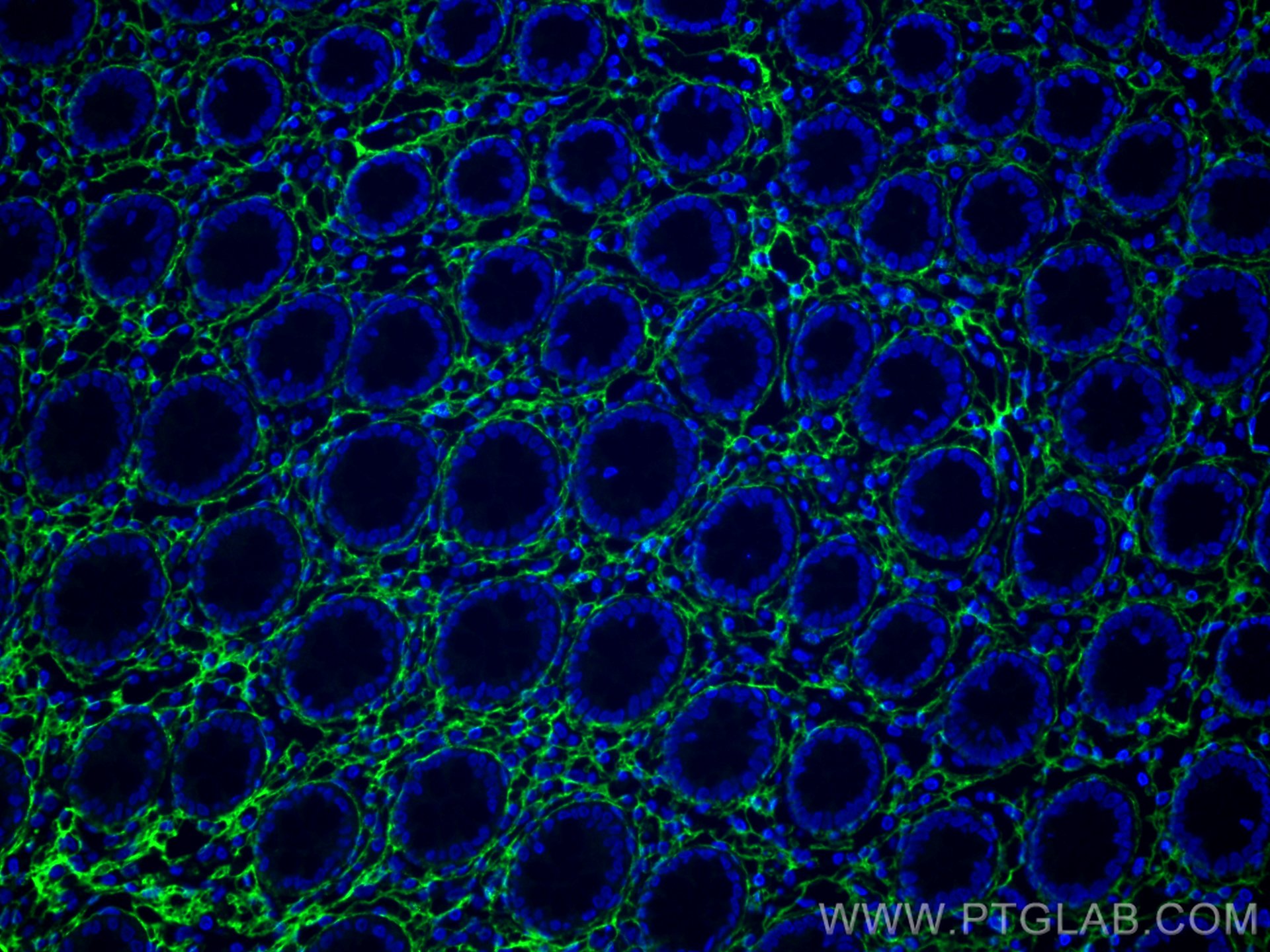Immunofluorescence (IF) / fluorescent staining of human colon tissue using Collagen Type III (N-terminal) Recombinant antibod (80009-1-RR)