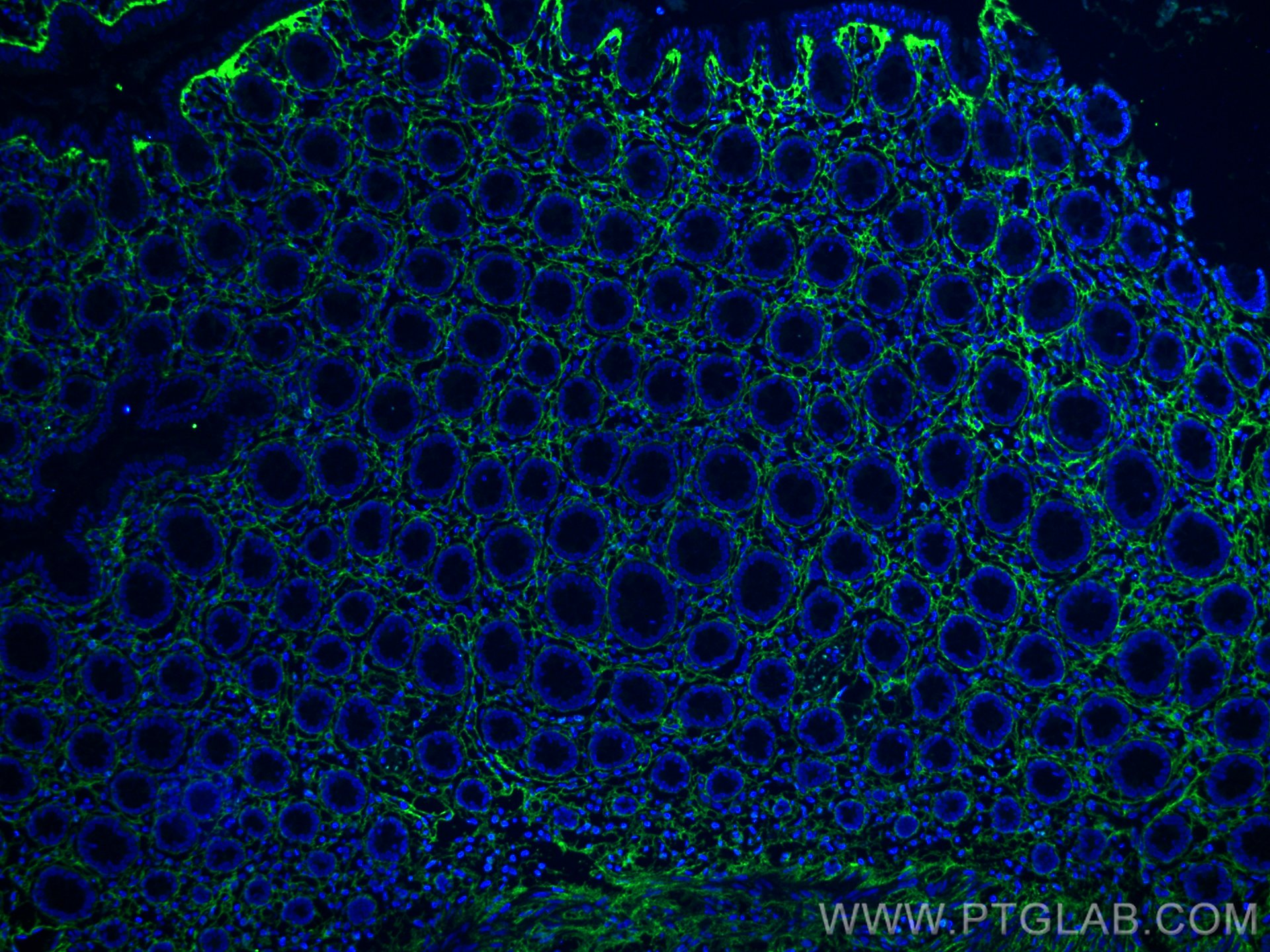 IF Staining of human colon using 80009-1-RR