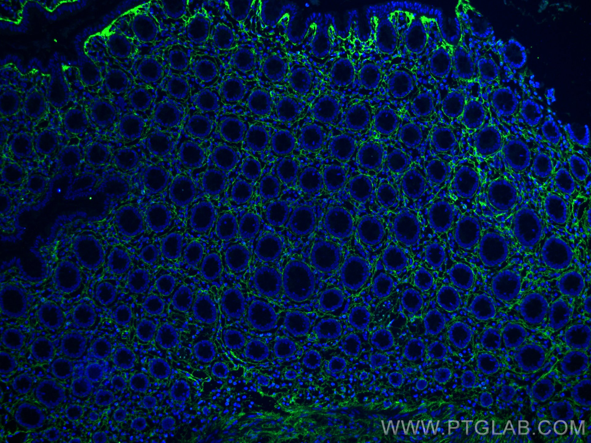 Immunofluorescence (IF) / fluorescent staining of human colon tissue using Collagen Type III (N-terminal) Recombinant antibod (80009-1-RR)