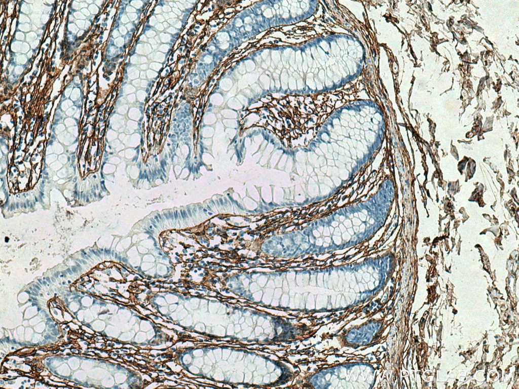 Immunohistochemistry (IHC) staining of human colon tissue using Collagen Type III (N-terminal) Recombinant antibod (80009-1-RR)