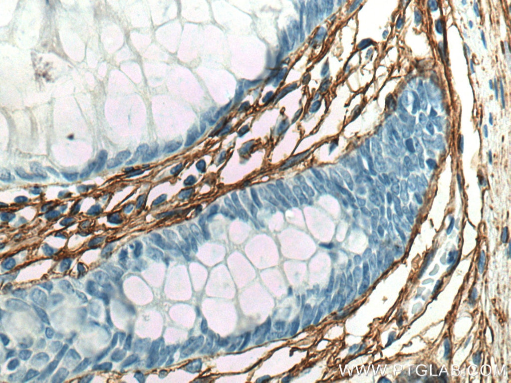 Immunohistochemistry (IHC) staining of human colon tissue using Collagen Type III (N-terminal) Recombinant antibod (80009-1-RR)