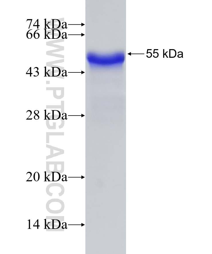 COL3A1 fusion protein Ag18658 SDS-PAGE