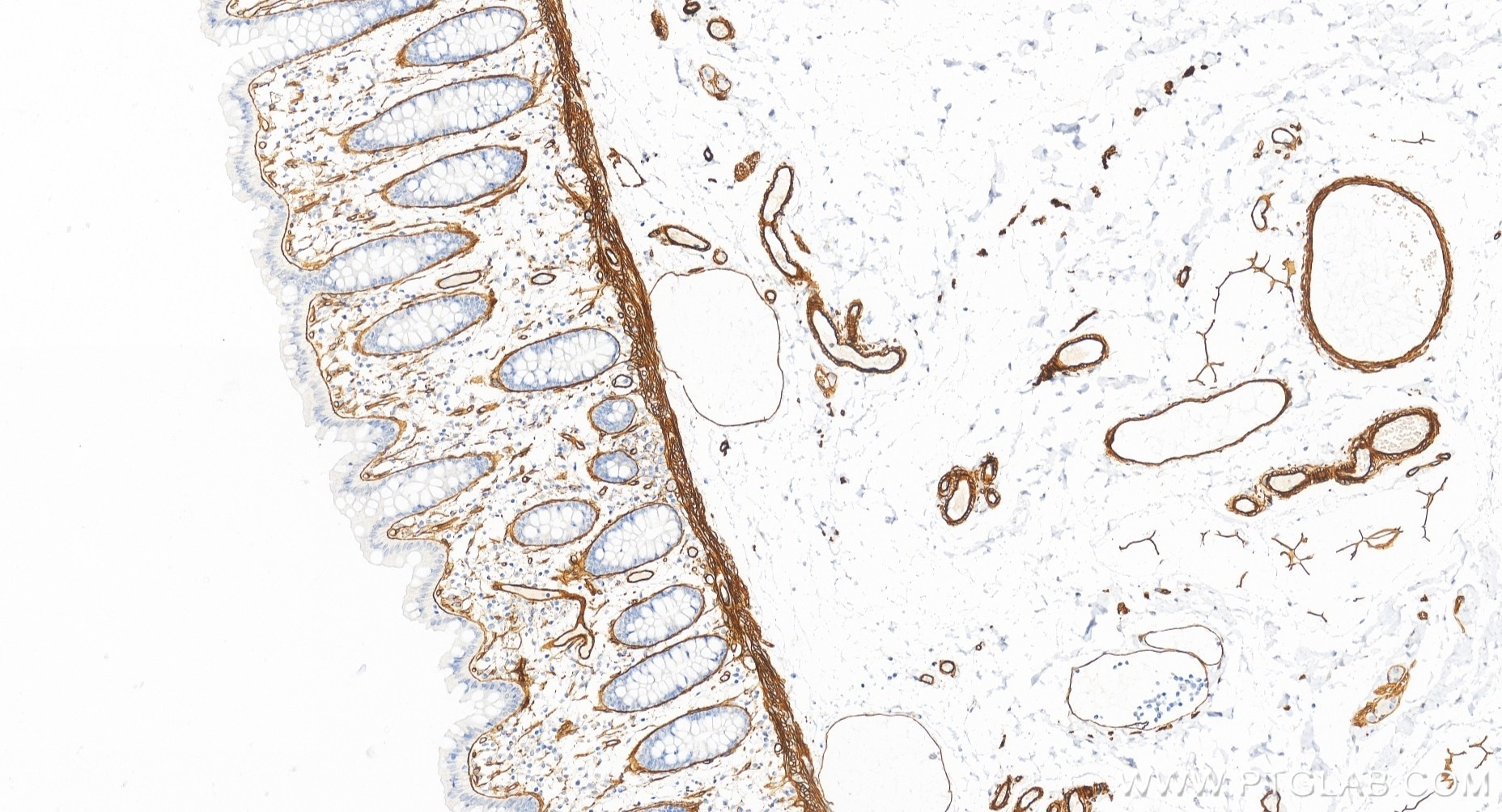 Immunohistochemical analysis of paraffin-embedded human colon tissue slide using 85256-4-RR (COL4A1 antibody) at dilution of 1:1500 (under 20x lens). Heat mediated antigen retrieval with Tris-EDTA buffer (pH 9.0). This data was developed using the same antibody clone with 85256-4-PBS in a different storage buffer formulation. Immunohistochemistry (IHC) staining of human colon tissue using COL4A1 Recombinant monoclonal antibody (85256-4-RR)