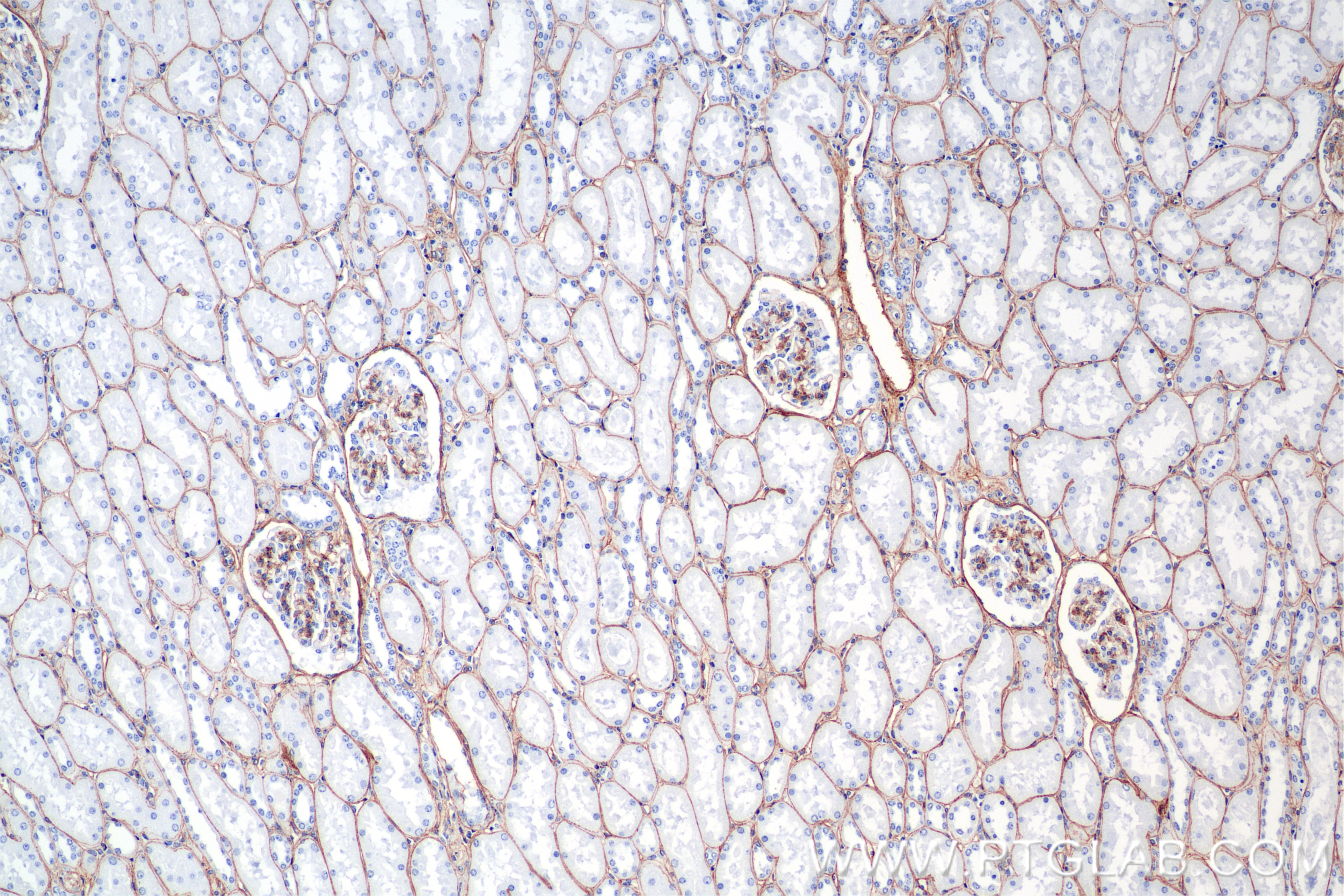 Immunohistochemical analysis of paraffin-embedded human kidney tissue slide using 85256-4-RR (COL4A1 antibody) at dilution of 1:1500 (under 10x lens). Heat mediated antigen retrieval with Tris-EDTA buffer (pH 9.0). This data was developed using the same antibody clone with 85256-4-PBS in a different storage buffer formulation. Immunohistochemistry (IHC) staining of human kidney tissue using COL4A1 Recombinant monoclonal antibody (85256-4-RR)