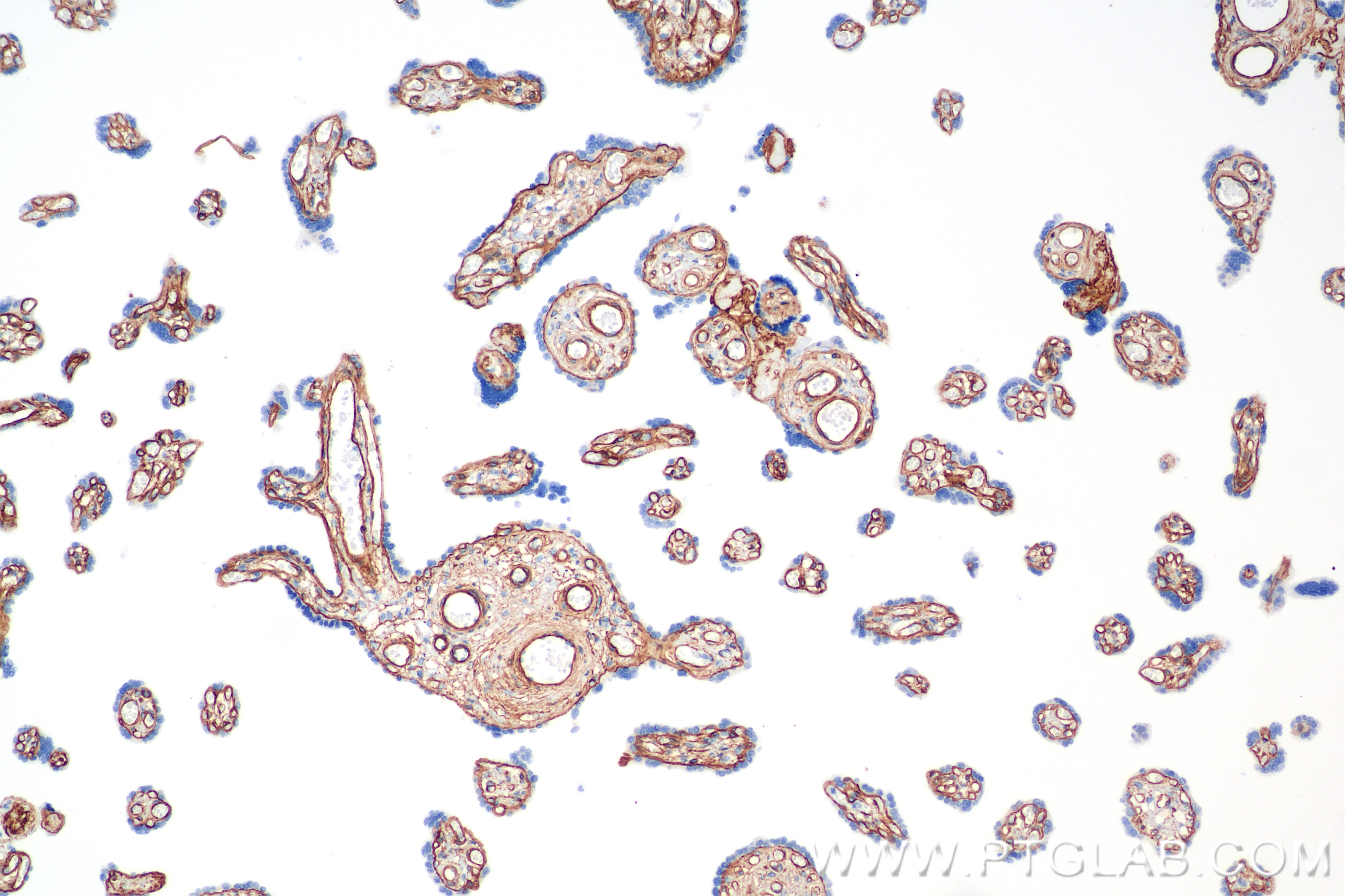 Immunohistochemical analysis of paraffin-embedded human placenta tissue slide using 85256-4-RR (COL4A1 antibody) at dilution of 1:1500 (under 10x lens). Heat mediated antigen retrieval with Tris-EDTA buffer (pH 9.0). This data was developed using the same antibody clone with 85256-4-PBS in a different storage buffer formulation. Immunohistochemistry (IHC) staining of human placenta tissue using COL4A1 Recombinant monoclonal antibody (85256-4-RR)