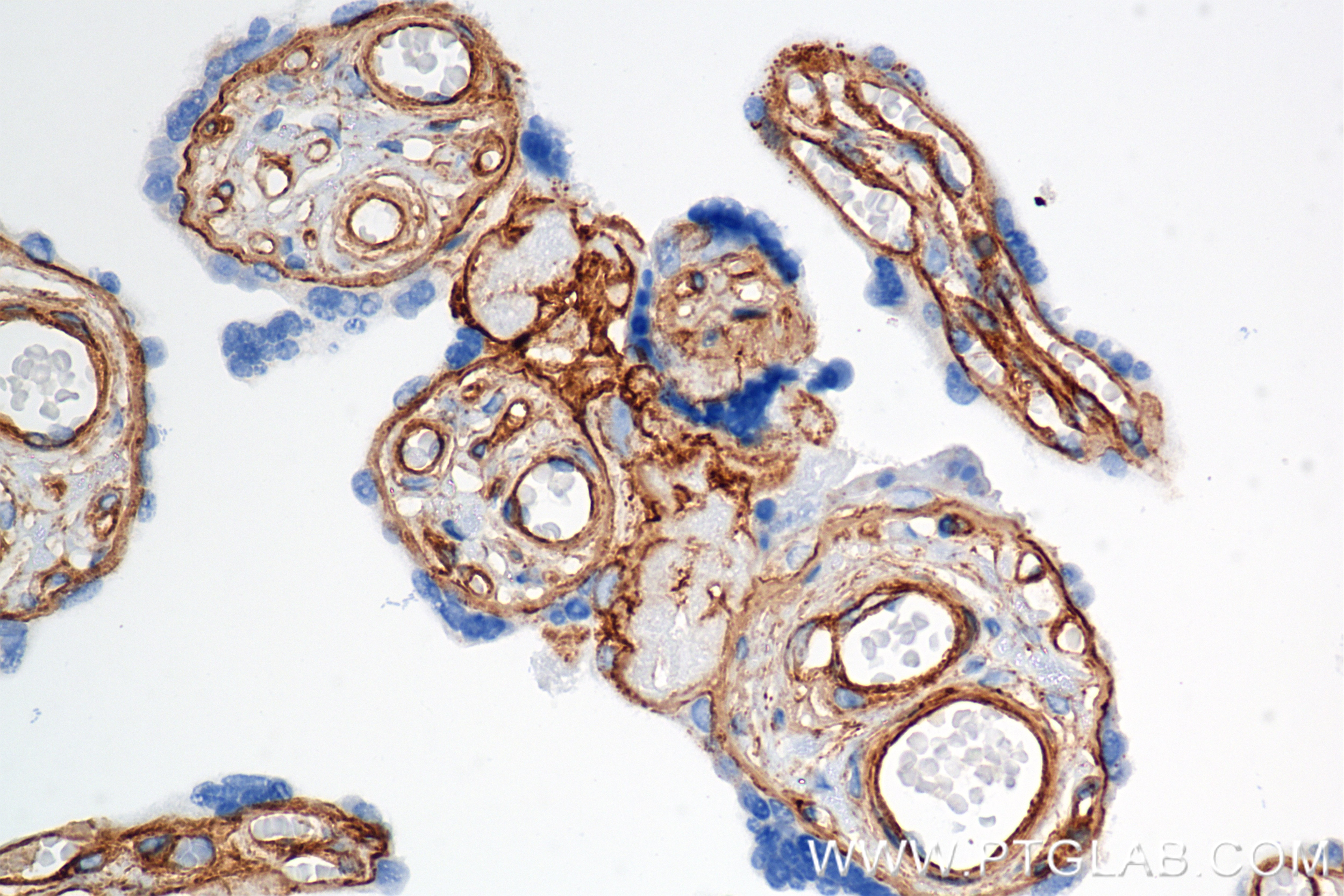 Immunohistochemical analysis of paraffin-embedded human placenta tissue slide using 85256-4-RR (COL4A1 antibody) at dilution of 1:1500 (under 40x lens). Heat mediated antigen retrieval with Tris-EDTA buffer (pH 9.0). This data was developed using the same antibody clone with 85256-4-PBS in a different storage buffer formulation. Immunohistochemistry (IHC) staining of human placenta tissue using COL4A1 Recombinant monoclonal antibody (85256-4-RR)