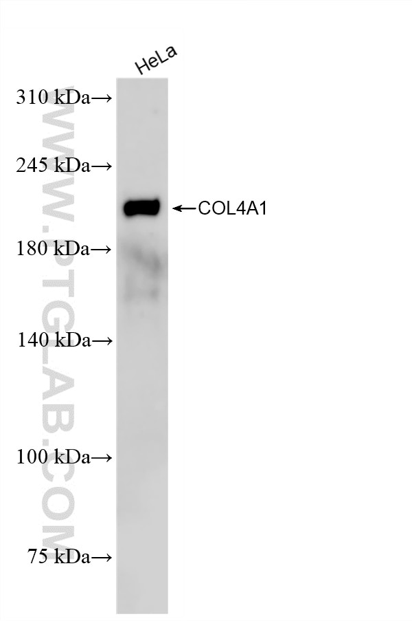 HeLa cells were subjected to SDS PAGE followed by western blot with 85256-4-RR (COL4A1 antibody) at dilution of 1:2000 incubated at room temperature for 1.5 hours. This data was developed using the same antibody clone with 85256-4-PBS in a different storage buffer formulation. Western Blot (WB) analysis of HeLa cells using COL4A1 Recombinant monoclonal antibody (85256-4-RR)