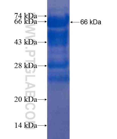 COL4A1 fusion protein Ag21443 SDS-PAGE